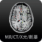 影像解剖图谱